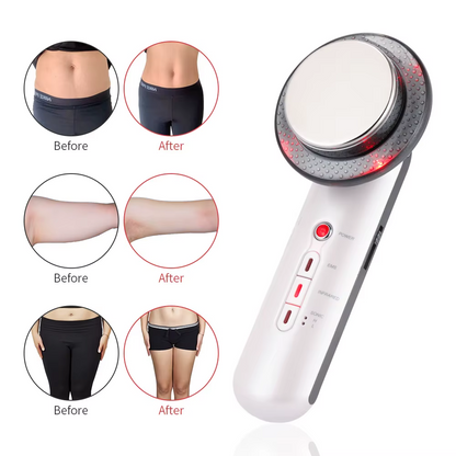 Ultrasonido Infrarrojo Skincare 3 En 1